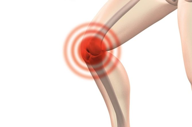 Una terapia innovativa per l’artrosi del ginocchio